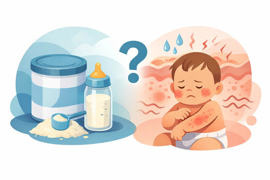 Can Formula Cause Eczema Flareups in Babies?